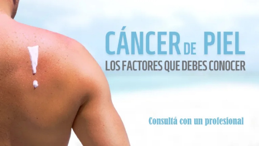 El Hospital Reconquista recomienda chequear  lunares para prevenir cáncer de piel