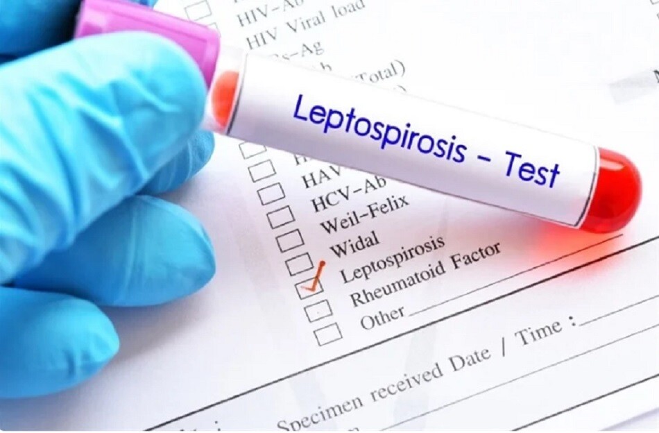 ¡Alerta! Reportaron un caso de leptospirosis en Reconquista ¿En qué animal?