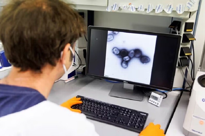 El Ministerio de Salud de informa la situación epidemiológica ante el alerta por viruela símica